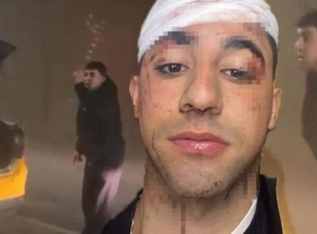 Motosikletli Genç Taksicinin Saldırısına Uğradı: Başına 6 Dikiş Atıldı!