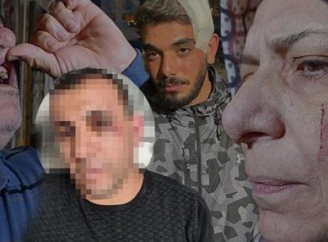 Komşuluk İlişkileri Çöktü: Adana’da Bıçaklı Saldırı ve Darp Olayı