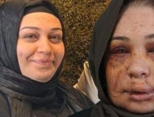 Evli Kadına Şok: Eşinden Tehdit ve Şiddetle Boşanma M&uuml;cadelesi