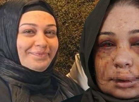 Evli Kadına Şok: Eşinden Tehdit ve Şiddetle Boşanma M&uuml;cadelesi