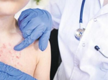 Su &Ccedil;i&ccedil;eği Uyarısı: Tek Doz Aşının Koruyuculuğu Zayıflıyor mu?