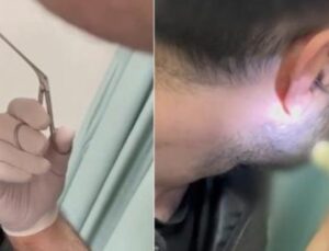 G&ouml;zaltına Alınan Ş&uuml;pheliden Uyuşturucu &Ccedil;ıkması Sağlık Kontrollerini Tartışma Konusu Yaptı!