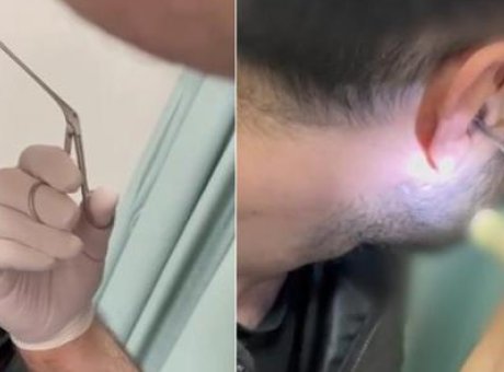 G&ouml;zaltına Alınan Ş&uuml;pheliden Uyuşturucu &Ccedil;ıkması Sağlık Kontrollerini Tartışma Konusu Yaptı!