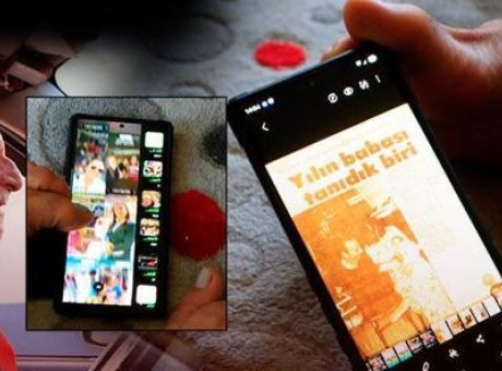 Ellerini Kaybetti Ama Hayatını Kazanmayı Başardı: Mehmet Temel’in İlham Verici Hikayesi