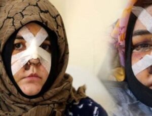 Eşine Kaldırım Taşıyla Saldırdı! Boşanma Davası Dehşete D&ouml;n&uuml;şt&uuml;