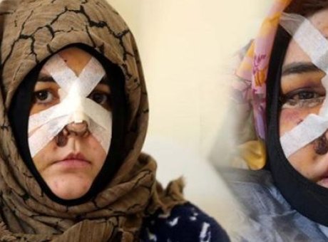 Eşine Kaldırım Taşıyla Saldırdı! Boşanma Davası Dehşete D&ouml;n&uuml;şt&uuml;