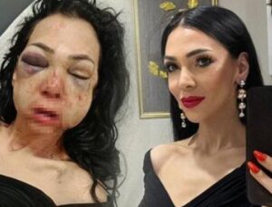 İzmit’te Bayram Dehşeti: Anne ve Oğul Saldırıya Uğradı, Hayatları Değişti!