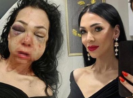 İzmit’te Bayram Dehşeti: Anne ve Oğul Saldırıya Uğradı, Hayatları Değişti!