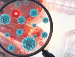 Kolon Kanseri Alarmı: T&uuml;rkiye’de Her Yıl 22 Bin Yeni Vaka!