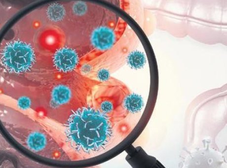 Kolon Kanseri Alarmı: T&uuml;rkiye’de Her Yıl 22 Bin Yeni Vaka!