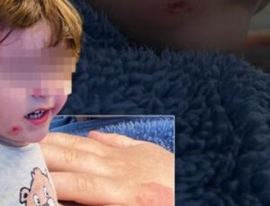 Kreş İddiaları Şoke Etti: 2,5 Yaşındaki &Ccedil;ocuğa Darp!