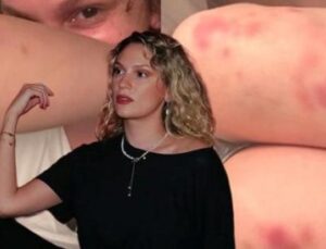 Farah Zeynep Abdullah’ın Paylaşımı Şok Etti: Morlukların Ardındaki Ger&ccedil;ek Ne?