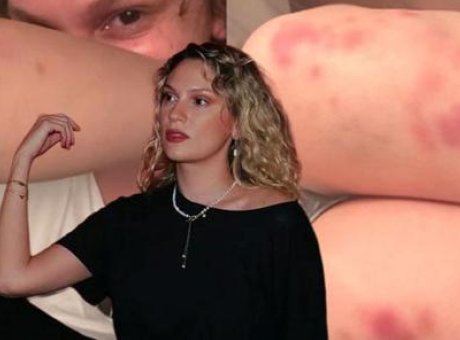 Farah Zeynep Abdullah'ın Paylaşımı Şok Etti: Morlukların Ardındaki Ger&ccedil;ek Ne?