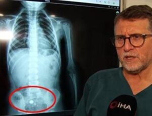 Şeker Zannedip Yuttu, Hayatı Tehlikeye Girdi! 4 Yaşındaki Kız &Ccedil;ocuğunun Dramatik Hikayesi