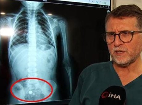 Şeker Zannedip Yuttu, Hayatı Tehlikeye Girdi! 4 Yaşındaki Kız &Ccedil;ocuğunun Dramatik Hikayesi