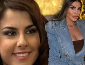 Tuğ&ccedil;e &Ouml;zbudak’ın D&ouml;n&uuml;ş&uuml;m&uuml; Şaşırttı: Eski Haline D&ouml;nmek İmkansız!