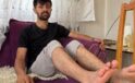 Diş Ağrısıyla Hastaneye Giden Gen&ccedil; Adamın Hayatı Değişti: Y&uuml;r&uuml;yemiyor!