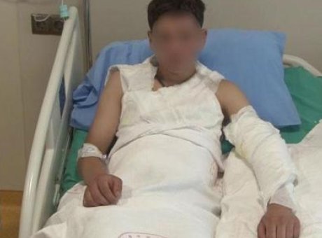 Kolonyalı Deneyim Kabusa D&ouml;n&uuml;şt&uuml;: 15 Yaşındaki &Ccedil;ocuğun Korkun&ccedil; Anları