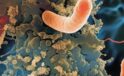 Peynirde Listeria İhlali: Sağlığınızı Tehdit Eden &Uuml;r&uuml;nler Hakkında Bilmeniz Gerekenler