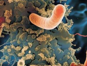 Peynirde Listeria İhlali: Sağlığınızı Tehdit Eden &Uuml;r&uuml;nler Hakkında Bilmeniz Gerekenler