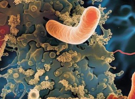 Peynirde Listeria İhlali: Sağlığınızı Tehdit Eden &Uuml;r&uuml;nler Hakkında Bilmeniz Gerekenler
