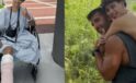 Survivor Yıldızından Y&uuml;rekleri Dağlayan A&ccedil;ıklama: Amputasyon Sonrası Hayat M&uuml;cadelesi