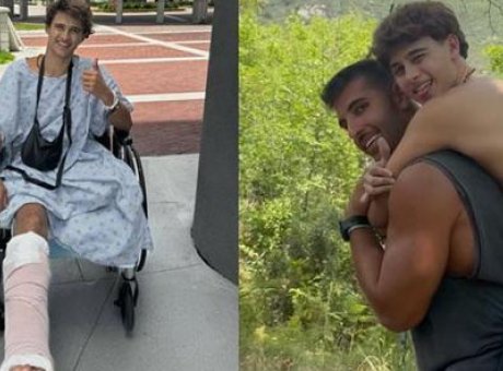 Survivor Yıldızından Y&uuml;rekleri Dağlayan A&ccedil;ıklama: Amputasyon Sonrası Hayat M&uuml;cadelesi