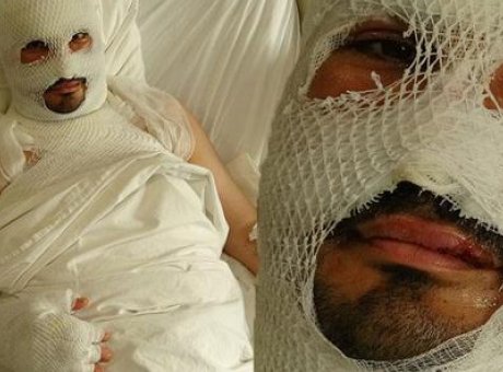 Alevlerin İ&ccedil;inden Kıl Payı Kurtulan Adamın Korkun&ccedil; Hikayesi