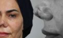Hayatı Kabusa D&ouml;nen Kadının Dramı: 4 Ameliyat Sonrası Y&uuml;zdeki Değişim