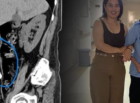 Kafatasını Karnında Taşıdı! Hayat Kurtaran Ameliyat Alaşehir’de Ger&ccedil;ekleşti