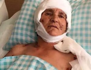 K&ouml;pek Saldırısında Şok Emsal Karar: 637 Bin Lira Tazminat Yolda!