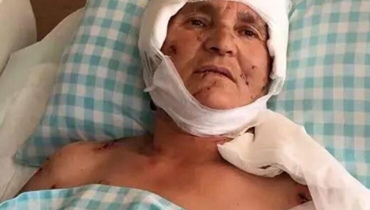 K&ouml;pek Saldırısında Şok Emsal Karar: 637 Bin Lira Tazminat Yolda!