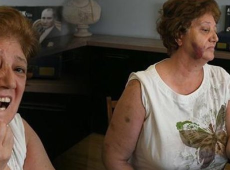 Kuşadası’nda Şok Olay: Evini Kiracıya Kaptıran Aile Darp Edildi!