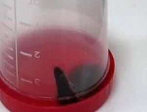 Siirt’te Şok Edici Sağlık Olayı: 6 Yaşındaki &Ccedil;ocuğun Boğazından S&uuml;l&uuml;k &Ccedil;ıktı!