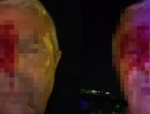 Sokaklarda Tehlike: Muhabir, &Ouml;l&uuml;me Giderken Saldırıya Uğradı!