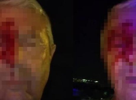 Sokaklarda Tehlike: Muhabir, &Ouml;l&uuml;me Giderken Saldırıya Uğradı!